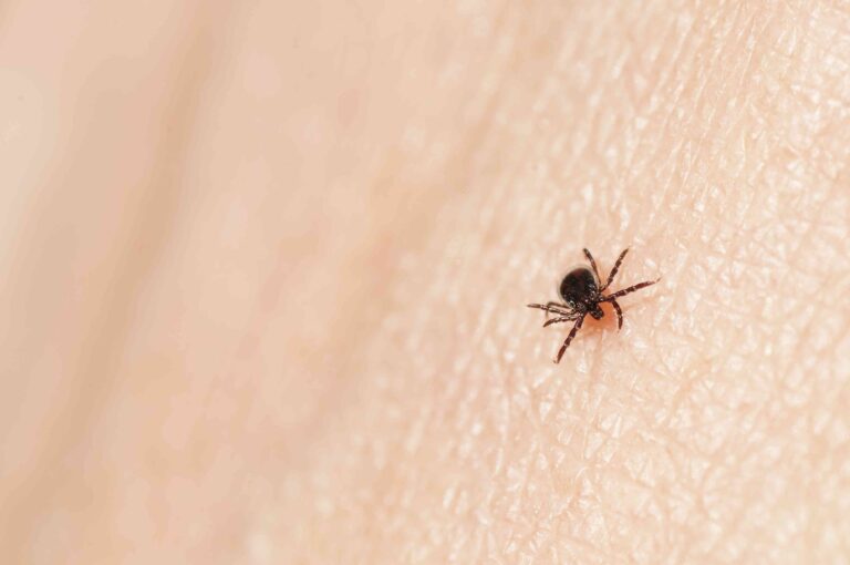 What Is Babezosis? Tick Borne Disease On The Rise In The