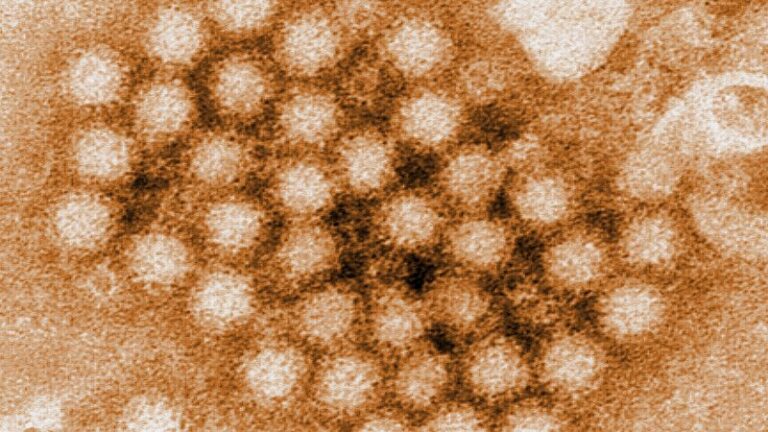 Norovirus Cases Continue To Rise In Us, Especially In The